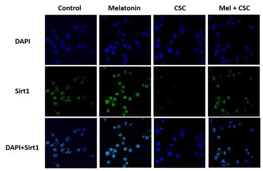 멜라토닌의 CSC로 자극된 J774세포에서 SRIT1의 발현양상