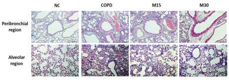 멜라토닌의 COPD 마우스에서 폐조직내 염증반응에 미치는 영향