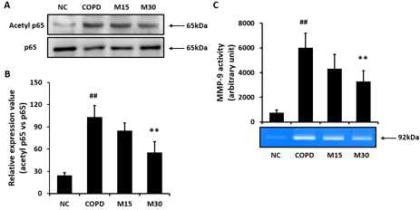 멜라토닌의 COPD 마우스에서 p65 아세틸화에 미치는 영향