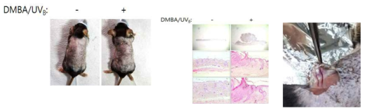 UVB로 유도한 피부암 모델 검증 및 angiotropism 발현 비교