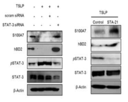STAT-3 siRNA 및 STA-21 처리에 따른 항균펩다이드 단백질 발현 확인