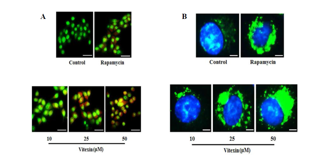 Vitexin induces autophagy and contributes to cell death. (A) Cells were treated with or without vitexin and rapamycin and stained with acridine orange to determine autophagosome formation (bright orange granules) using a fluorescence microscope (scale bar = 0.1 mm). Quantitative analysis of autophagosome formation. (B) Autophagic vesicles (green) stained with Cyto-ID Green autophagy dye and nuclei counterstained with Hoechst 33342 (blue) were observed by fluorescence microscopy (scale bar = 50 μm)