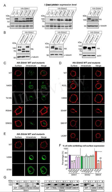 Slitrk1, Slitrk2, Slitrk4 missense mutants의 발현 및 세포 표면 발현 분석: immunoblotting, immunofluorescence analysis, surface biotinylation 등을 통해서 각종 missense mutants의 특성을 분석함