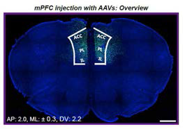 AAV 바이러스를 마우스 전전두엽에 stereotaxic injection 실시