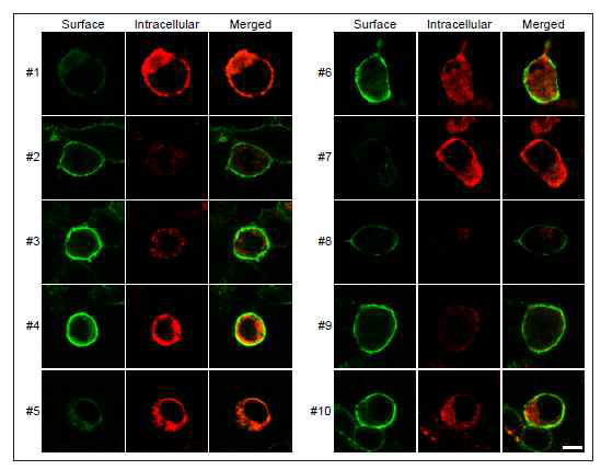 Slitrk1/3 swapping constructs의 surface localization pattern 분석: HEK293T에 #1-10을 발현시킨 뒤에 surface/intracellular protein distribution을 분석한 결과, #1, #5, #7의 경우 intracellular compartment에 trapping되었음을 확인하였음