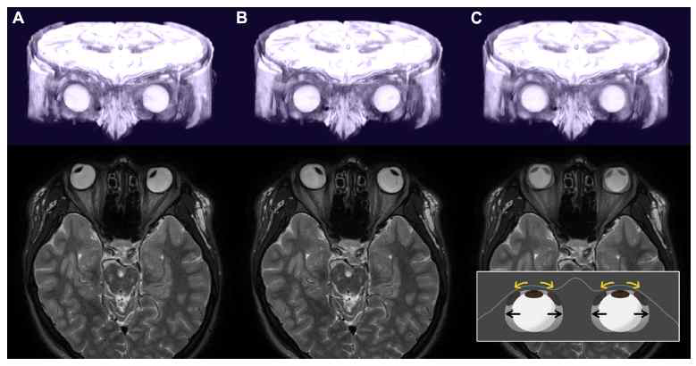 논문 게재 3차원 MRI 영상