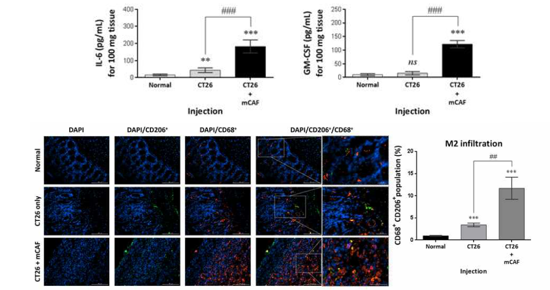 CAF 공동 주입에 따른 종양 조직 내 IL-6와 GM-CSF 증가 및 종양 촉진형 면역세포의 침윤