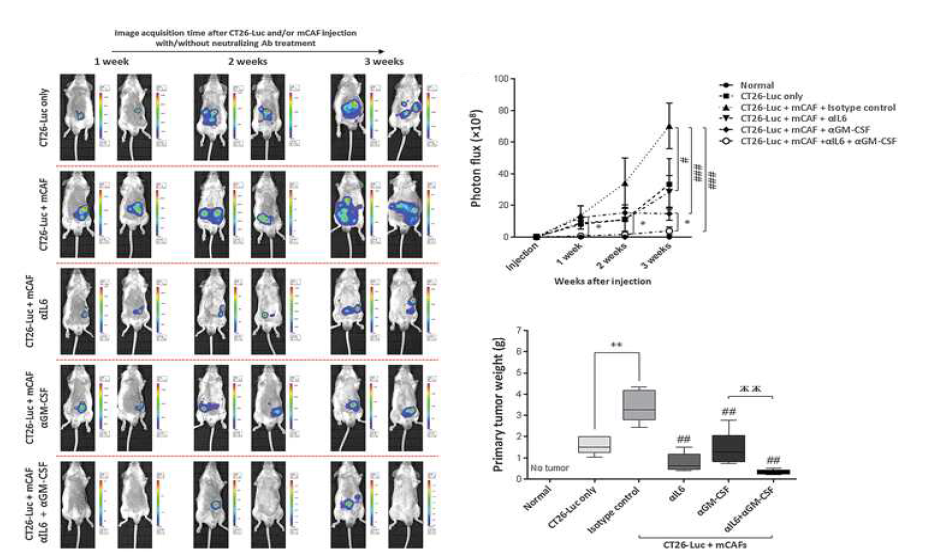 Neutralizing Ab에 의한 IL-6와 GM-CSF blocking을 통한 종양 발달 저해 효과 확인