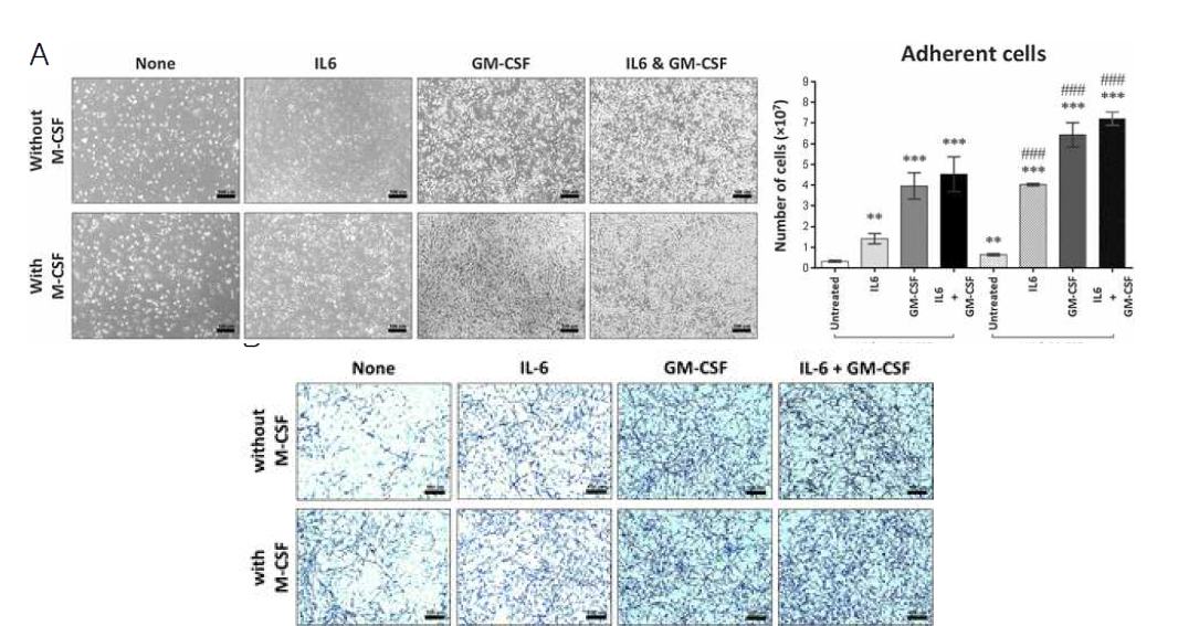 마우스 유래의 monocyte분리 및 세포주 실험의 재현을 통한 종양 촉진형 macrophage의 분화확인