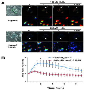 Catalase deficiency increases peroxisomal ROS in the hepatocytes