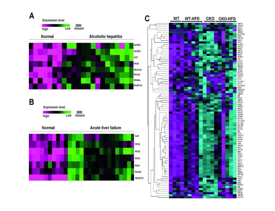 Abnormalities of peroxisomal genes in human and mice liver