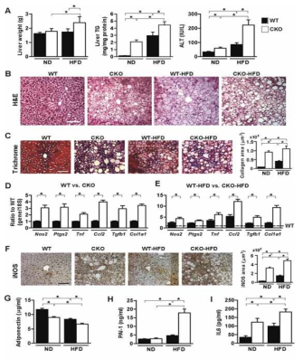 Hepatic steatosis and injury in CKO mice
