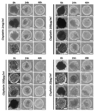 3차원 간암세포패턴 단위구조체에 대한 시스플라틴 효과 확인을 위한 스크리닝 광학 현미경이미지(scale bar=100um)