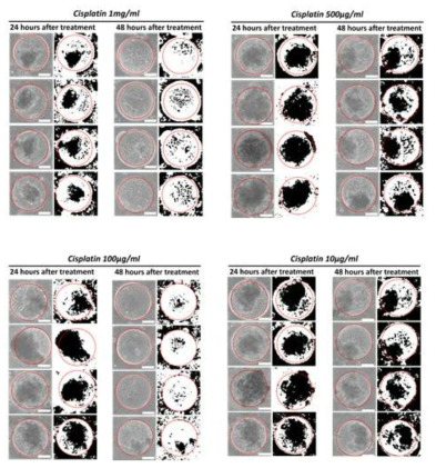 시스플라틴 처리후 간암세포 변화에 관한 광학이미지 및 이분화 이미지