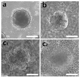 고분자 화합물 기반 3차원 세포패턴 단위구조체 제작용 플랫폼에서 생성된 간암세포 스페로이드(a) 및 정상간세포와의 공배양 후 간암세포 스페로이드(b), 공배양 48시간 경과 후 간암세포 스페로이드의 형태 변화(c1, c2)에 대한 광학현미경 이미지. C1, C2는 같은 스페로이드를 초점만 달리하여 촬영한 것임 (scale bar=100um)