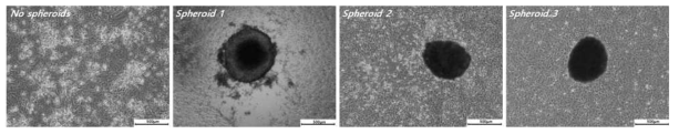 칩 상에서의 인간 간 암세포 3D 스페로이드 (HepG2)/정상 인간 간세포 (hESC•derived hepatocytes) 장기간 (D5) 공배양 결과