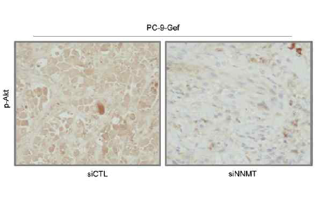 p-Akt의 immunohistochemistry결과