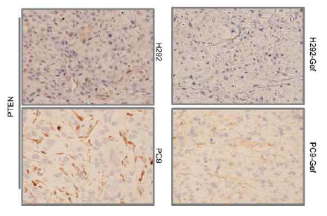 PTEN의 immunohistochemistry결과