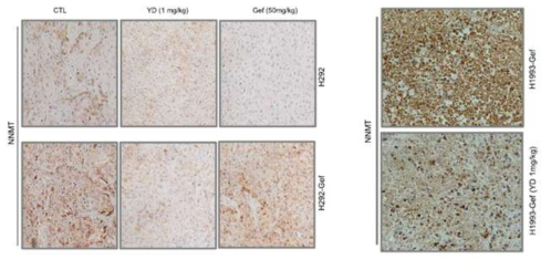 tumor xenograft 모델에서 YD 투여시 NNMT의 immunohistochemistry 결과