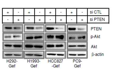 PTEN siRNA에 의한 Akt 발현 변화