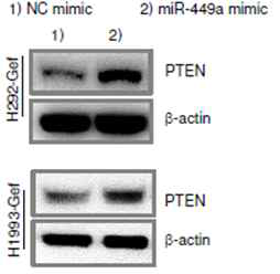 miR-449a에 의한 PTEN 발현 변화