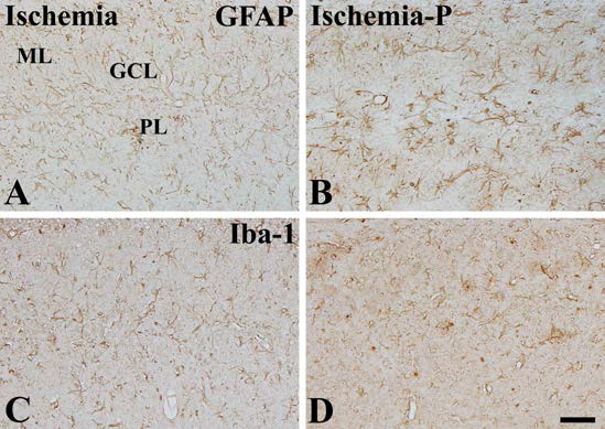 Immunohistochemical staining for glial fibrillary acidic protein and ionized calcium-binding adapter molecule 1 in the hippocampus of ischemia-operated group without neurogenic protocol (Ischemia, A and C), and ischemia-operated group with neurogenic protocol (B and D). Scale bar = 50 μm