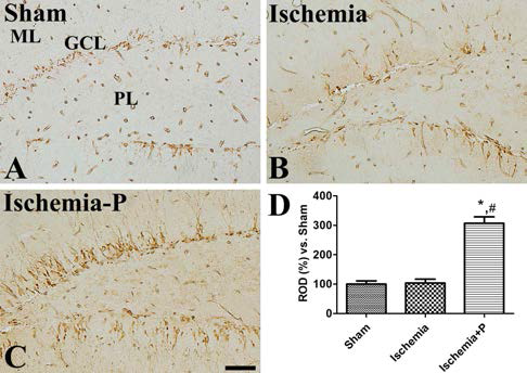 Immunohistochemiscal staining for DCX in the hippocampus of sham-operated (Sham, A), ischemia-operated group without neurogenic protocol G (Ischemia, B), and ischemia-operated group with neurogenic protocol G (Ischemia-P, C). Scale bar = 50 μm. D: The relative density of DCX immunoreactivity per section in all the groups (n = 5 per group; *P < 0.05, significantly different from the Sham group, #P < 0.05, significantly different from the Ischemia group). The bars indicate standard error of the mean (SEM)