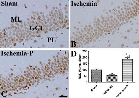 Immunohistochemiscal staining for phosphorylated cAMP response elements binding protein (pCREB) in the hippocampus of sham-operated (Sham, A), ischemia-operated group without neurogenic protocol (Ischemia, B), and ischemia-operated group with neurogenic protocol (Ischemia-P, C). Scale bar = 50 μm. D: The relative density of pCREB immunoreactivity per section in all the groups (n = 5 per group; *P < 0.05, significantly different from the Sham group, #P < 0.05, significantly different from the Ischemia group). The bars indicate standard error of the mean (SEM)