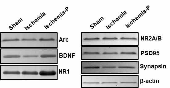 Western blot analysis of Arc, BDNF, NR1, NR2A/B, PSD95, and synapsin in the hippocampal homogenates of the sham-operated (Sham), ischemia-operated group without neurogenic protocol (Ischemia), and ischemia-operated group with neurogenic protocol (Ischemia-P)