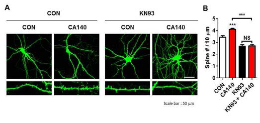 CA140에 의한 dendrite spine 형성과 p-CamKIIα의 연관성 확인