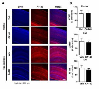 알츠하이머 모델 9 month PS19에서 CA140에 의한 AT180 level 변화