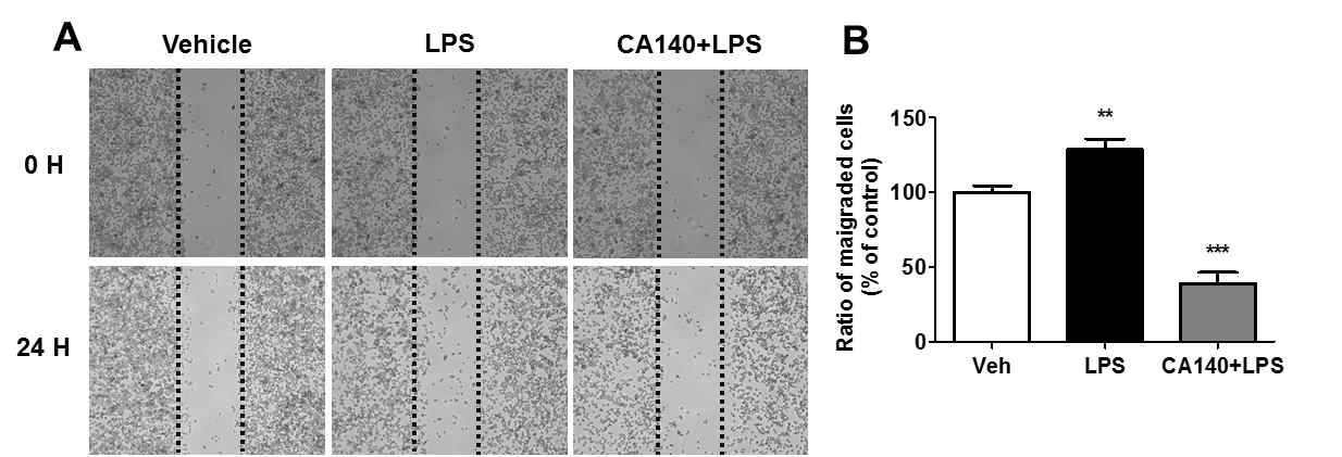 BV2 microglial cell에서 CA140의 migration에 미치는 영향