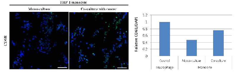 췌장암구상체와의 공배양 시, 단핵구세포에서 CD68 발현의 증가