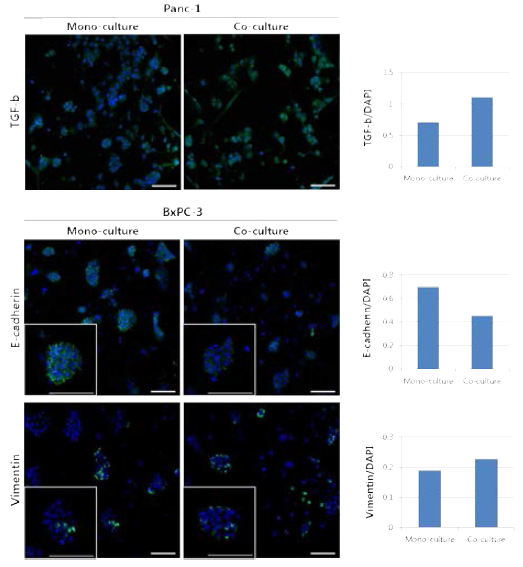 대식세포와의 공배양한 암구상체에서 TGF-β1 발현 증가 (PANC-1), E-cadherin 발현 감소, Vimentin 발현 증가 (BxPC-3)