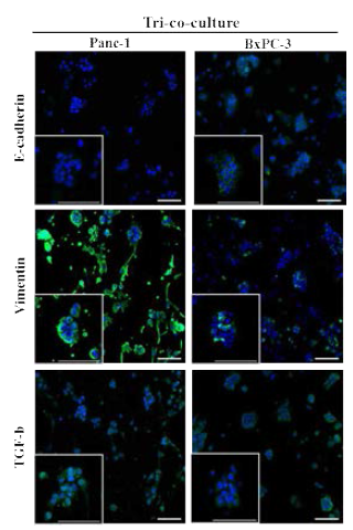 삼중공배양 모델 내 암세포 주의 특성에 따른 E-cadherin, Vimentin, TGF-β1 발현 확인