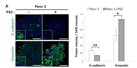 췌장성상세포 공존시 E-cadherin 발현 감소 및 Vimentin 발현 증가