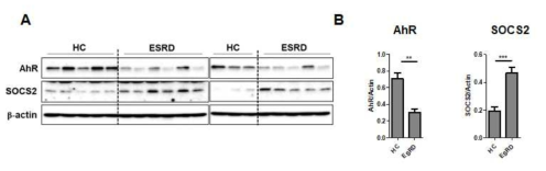 말기 신부전증 환자와 정상대조군의 단핵구에서의 AhR과 SOCS2의 발현. A, western blot analysis. B, 정량화 그래프