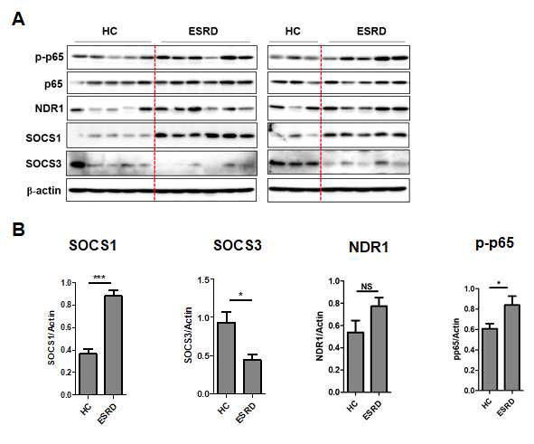 말기 신부전증 환자와 정상대조군의 단핵구에서의 단백질 변화. A, western blot analysis, B, 정량화 그래프