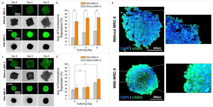 다세포 종양 오가노이드 형성에서 섬유아세포에 의한 transforming growth factor-beta(TGF-β)의 활성화를 통한 myofibroblasts 표지자인 αSMA의 높은 발현
