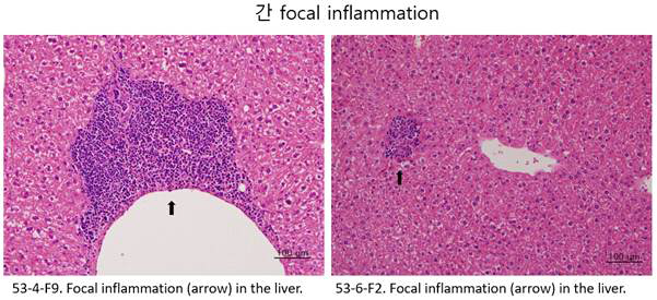 Krt26 WT와 KO female mouse의 focal inflammation in the liver