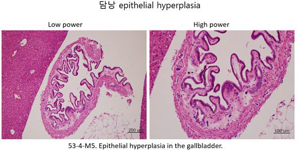 Krt26 WT male mouse의 Epithelial hyperplasia in the gallbladder