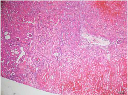 69-3-M6 (Homozygote type 16weeks male), kidney, mouse, H&E, X40