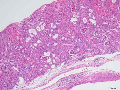 54-4-F7 (wild type 60 weeks female), pancreas, mouse, H&E, X100 Glomerulotubulonephropathy, moderate Pelvic dilatation, slight