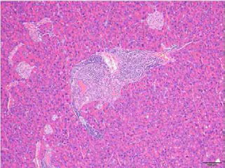 54-6-F6 (homozygote type 60 weeks female), kidney, mouse, H&E, X100 Perivascular inflammatory cell infiltration minimal focal