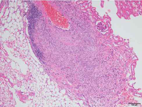 54-4-M7 (wild type 60 weeks male), kidney, mouse, H&E, X100 Arteritis nodosa, moderate