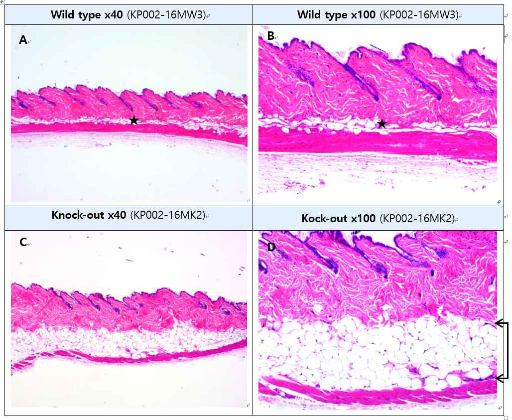 Viperin KO 마우스와 WT 마우스의 피하지방층 비교 (H&E straining) A: Wild type Skin, B : High-magnification of A, C: Knock-out Skin, D : High-magnification of C