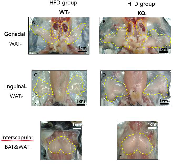HFD를 한 그룹에서 KO과 WT 마우스 부검 시 지방조직 사진 비교