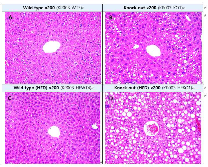 IDH2 KO과 WT마우스의 fatty liver change (H&E staining) A : Wild type liver, B : Knock-out liver, C: High fat diet wild type liver, D : High fat diet knock-out liver