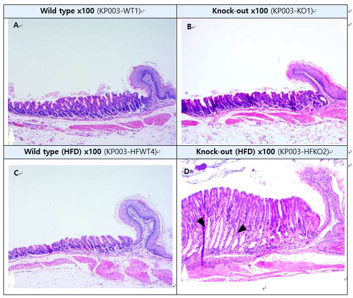 IDH2 KO과 WT마우스 위에서 발견된 SPEM (H&E staining) A: Wild type stomach, B : : Knock-out stomach, C: High fat diet wild type stomach, D : High fat diet knock-out stomach