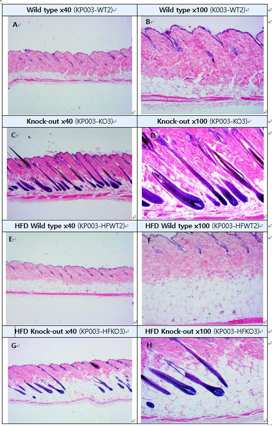 IDH2 KO과 WT마우스의 피하지방층과 모낭 (H&E staining) A: Wild type skin, B: High-magnification of A, C : Knock-out skin, D: High-magnification of C, E: High fat diet wild type skin, F: High-magnification of E, G : High fat diet knock-out skin, H: High-magnification of G